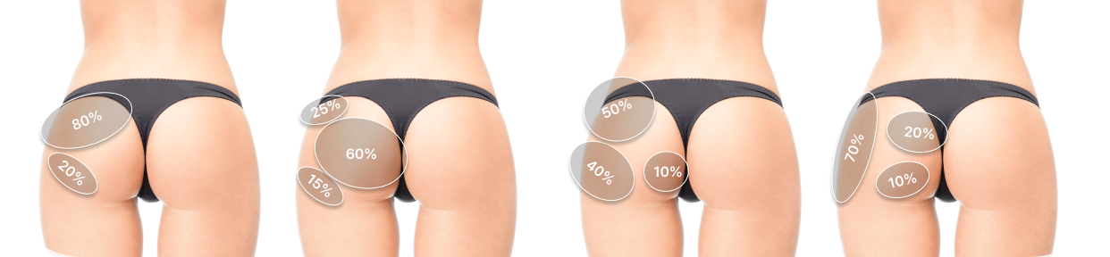 Hip Design Package