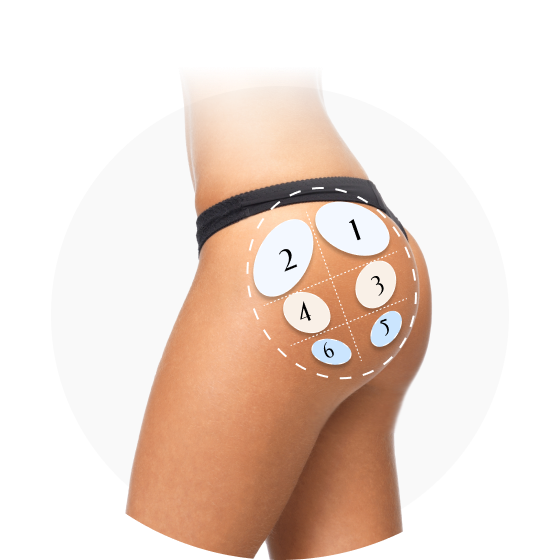 Hip Type 1-6