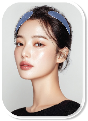 옆통수