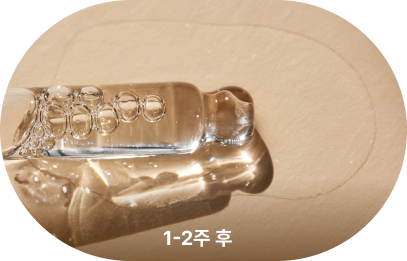 1-2.5 후 효과 이미지